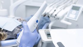 Gloved hand holds intraoral 3D scanner for digital impression and CAD CAM workflow in modern dental office