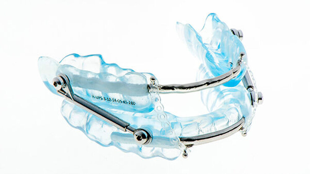 Abbildung 1c: H-UPS® (Hamburger-Unterkieferprotrusionsschiene nach J. Schlieper) |