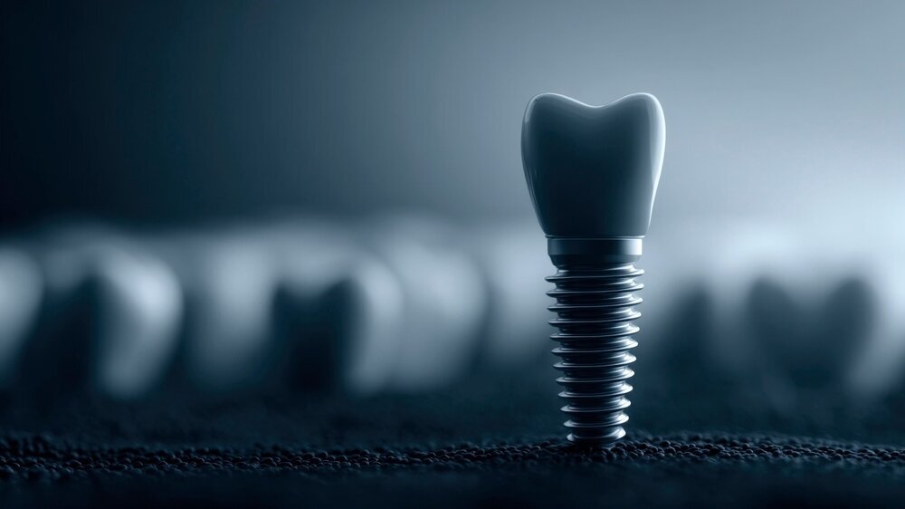 Dental Implant Close-Up: Modern Dentistry, Tooth Restoration, and Oral Health Solution Implantat