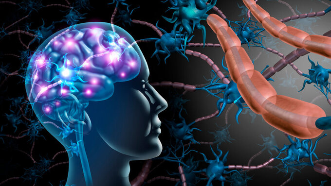 Brain Nerve Cells Multiple Sklerose, Gehirnnervenzellen