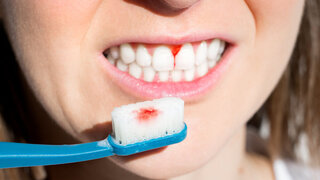 Woman with bleeding gums during teeth brushing. Hard toothbrush problem. Periodontal disease, avitaminosis, gingivitis, scurvy. High quality photo