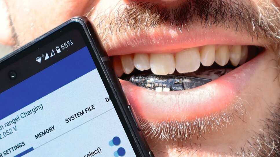 Batterielose Zahnspange