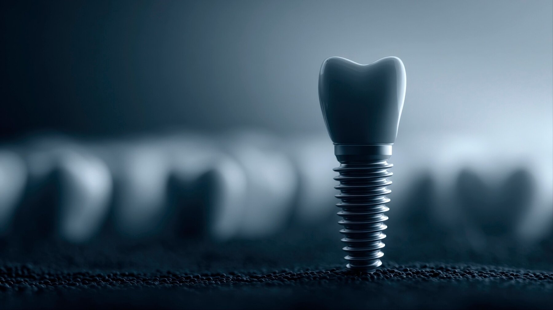 Implantat