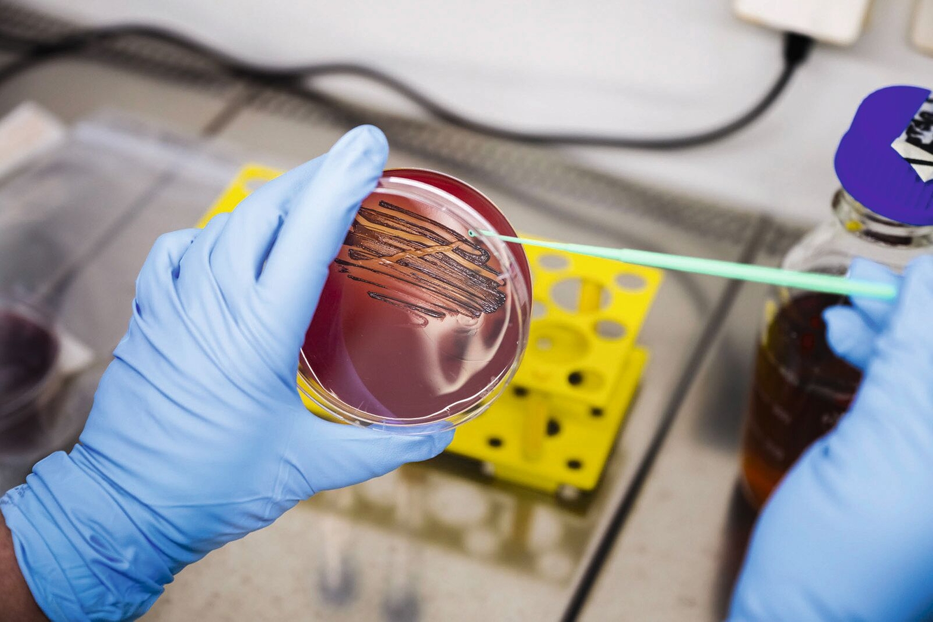 Neue Zahnpasta stoppt Parodontitis-Erreger Überimpfen einer P. gingivalis-Probe nach Kultivierung zur weiteren Testung des Wirkstoffes. Die Bakterien werden im Labor auf Petrischalen auf einem Nährmedium (Agar) gezüchtet.