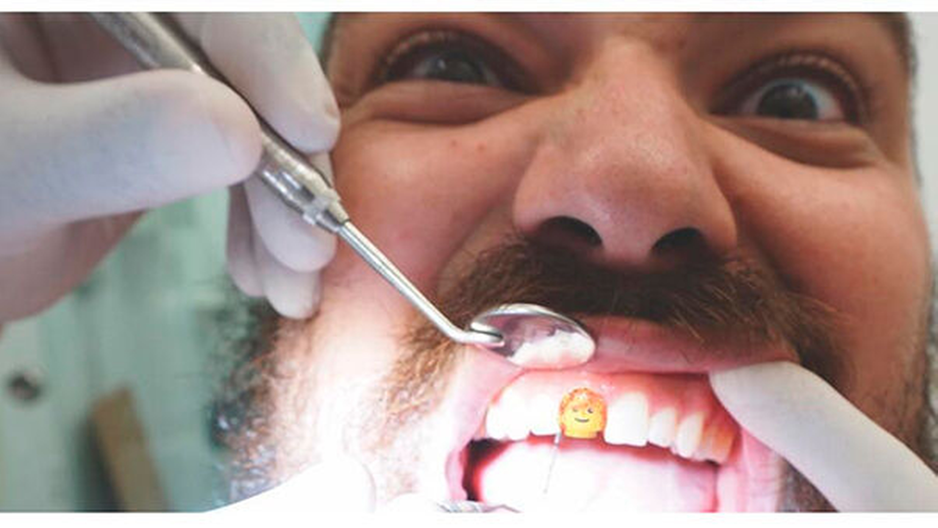 Grillz? Gold? Nein, ein Lego-Männchen als Implantat! - zm-online